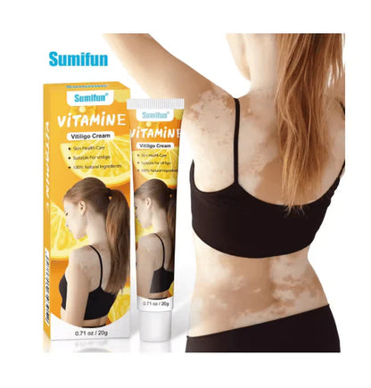 Sumifun - Vitamine Vitiligo Cream (Original)